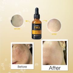 Kyung Lab Tinh chất Pure Trx Pigment Control 30ml