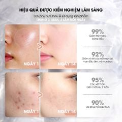 Neogen Serum dưỡng da Niacinamide 15% + Zin c + Ferulic 30ml