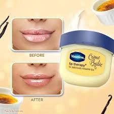Sáp Dưỡng Môi Vaseline lip therapy Mềm Mịn 7g-vàng