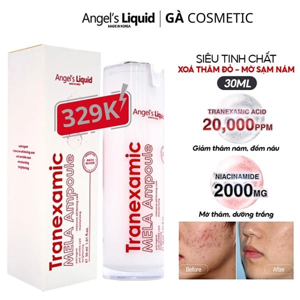 tinh chất siêu làm trắng mờ thâm nám Angle’s liquid tranexamic mela ampoule serum 30ml