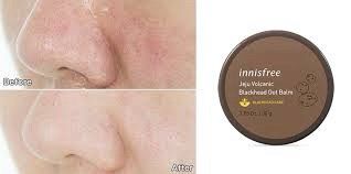 sáp trị mụn đầu đen Innisfree jeju volcanic blackhead out balm