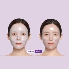 Mặt nạ thạch MediAnswer Vita Collagen Nano Shot bản cải tiến #tím