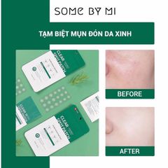 Miếng dán mụn Some By Mi Clear Spot Patch (18 miếng)