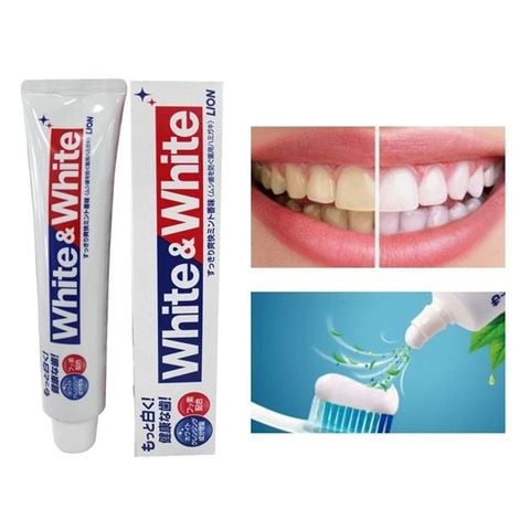Kem đánh răng White And White Nhật Bản