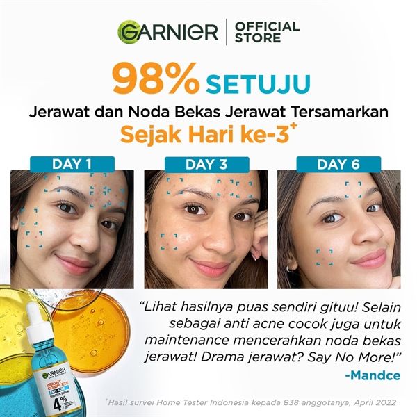 Serum Garnier Giảm Mụn Mờ Thâm Cho Da Dầu, Mụn 30ml
