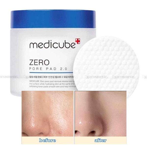Toner Không Lỗ Chân Lông ZERO PORE PAD 70 miếng