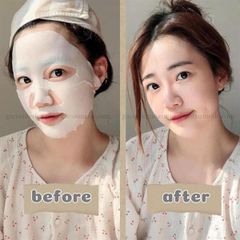 Mặt Nạ Rejuran Skin Protection Mask Cấp Ẩm, Phục Hồi Da 27ml