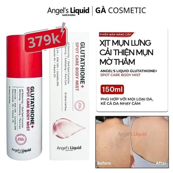 Xịt mụn lưng làm trắng giảm mụn Angle’s liquid glutathion