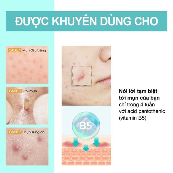 Kem dưỡng Numbuzin No1 Pantothenic B5 Active Smoothing 80ml