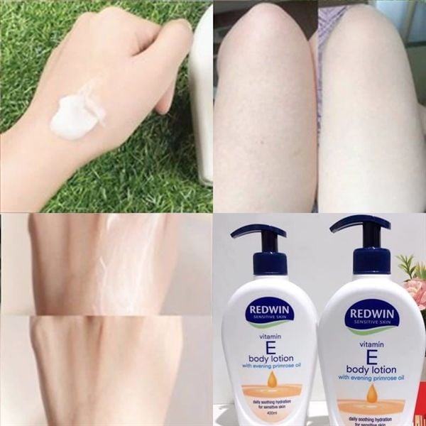 Dưỡng thể vitamin E body lotion Redwin 400ml (Vòi)