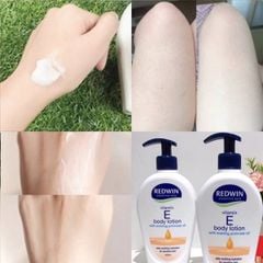 Dưỡng thể vitamin E body lotion Redwin 400ml (Vòi)