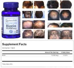 Viên Uống Hỗ Trợ Giảm Rụng Tóc Đẹp Da Biotin Ultra Mega Puritan's Pride, 100 viên