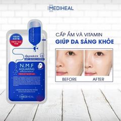 Mặt Nạ Mediheal Tinh Chất cấp ẩm 25ml