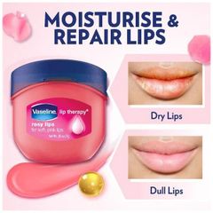 Sáp Dưỡng Môi Vaseline Lips Therapy Rosy Lips Hoa Hồng 7Gr