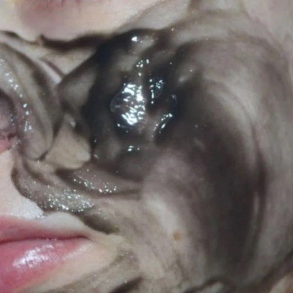 Mặt Nạ Ngăn Ngừa Mụn Café Mimi Anti-Acne Face Mask