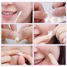 Miếng Dán Mụn Acnes Clear Patch