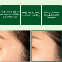 Miếng dán mụn Some By Mi Clear Spot Patch (18 miếng)