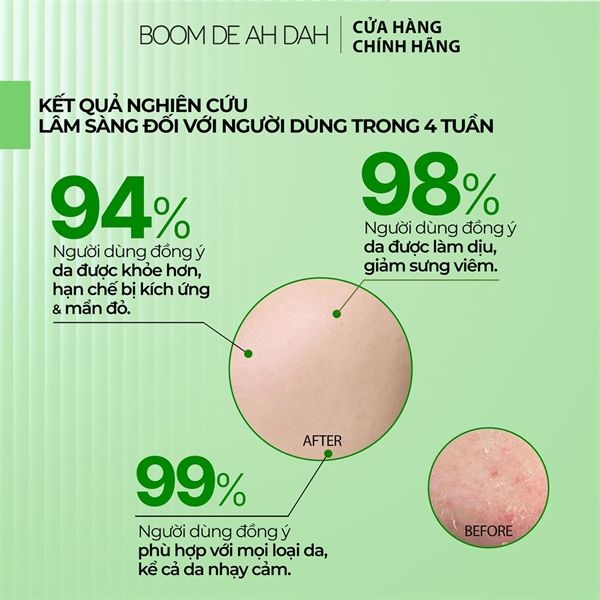 Serum Giúp Làm Dịu, Hỗ Trợ Phục Hồi, Giảm Mụn Boom De Ah Dah Growth Factors Calming Ampoule 50ml