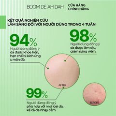 Serum Giúp Làm Dịu, Hỗ Trợ Phục Hồi, Giảm Mụn Boom De Ah Dah Growth Factors Calming Ampoule 50ml