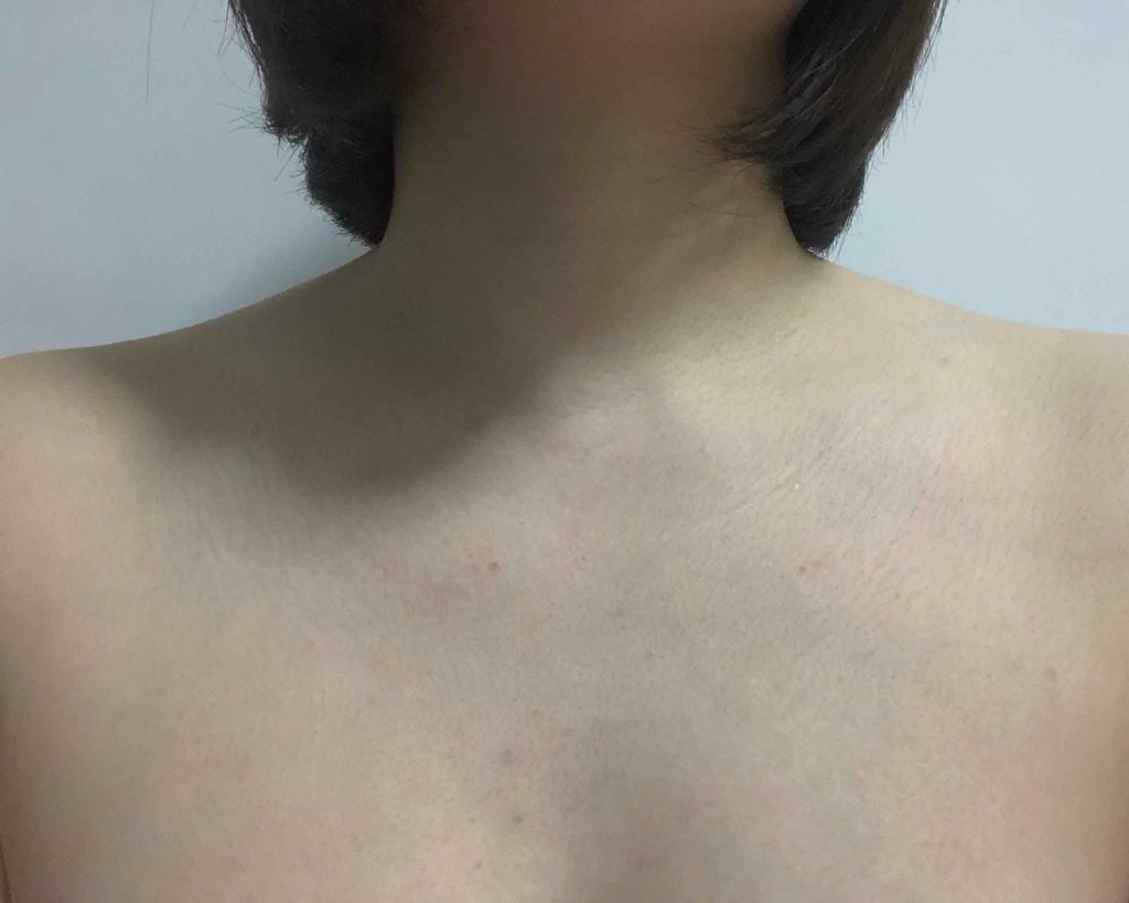 Xà Phòng Trị Mụn Lưng Pelican For Back Medicated Soap 135g