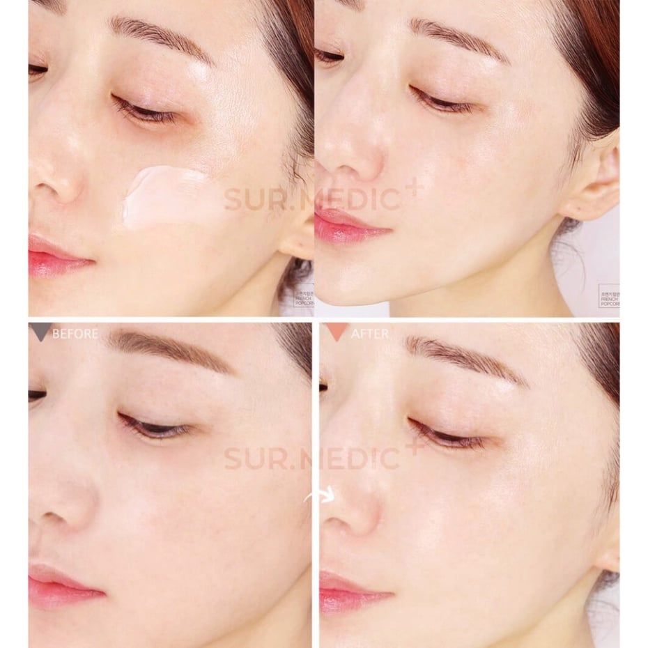 Nước Hoa Hồng Dưỡng Trắng Da Sur.Medic+ Super Glutathione 100 Bright Skin 145ml