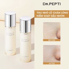 Nước Hoa Hồng Dưỡng Da Căng Bóng Dr.Pepti+ Centella Toner 180ml