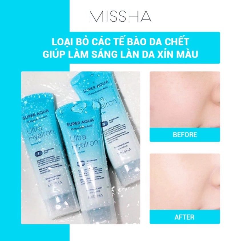 Gel Tẩy Tế Bào Chết MISSHA Super Aqua Ultra Hyalron Peeling Gel 100ml