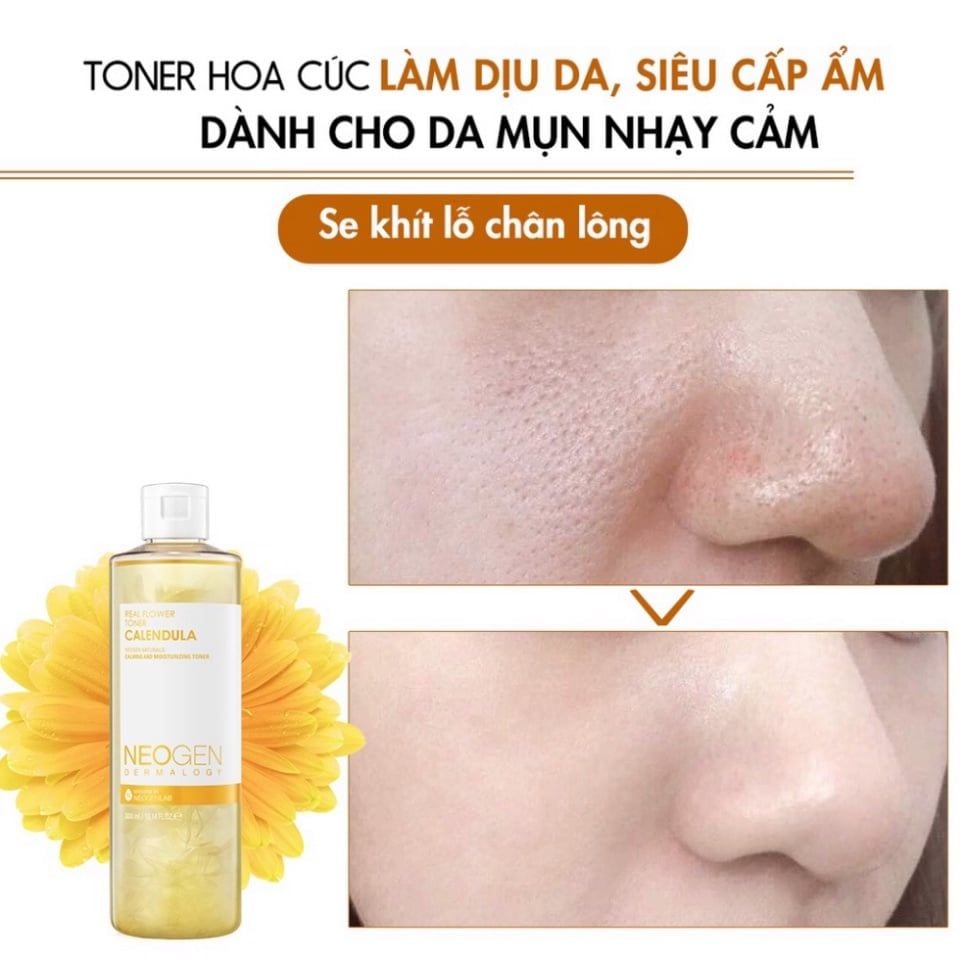 Nước Hoa Hồng Chiết Xuất Hoa Cúc Cấp Ẩm, Dịu Da Neogen Dermalogy Real Flower Calendula Toner 300ml