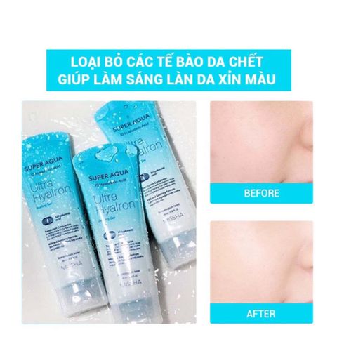 Gel Tẩy Tế Bào Chết MISSHA Super Aqua Ultra Hyalron Peeling Gel 100ml