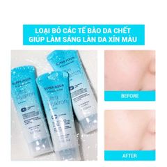Gel Tẩy Tế Bào Chết MISSHA Super Aqua Ultra Hyalron Peeling Gel 100ml