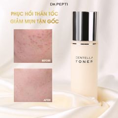 Nước Hoa Hồng Dưỡng Da Căng Bóng Dr.Pepti+ Centella Toner 180ml