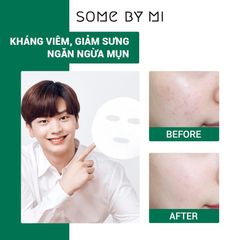 Mặt Nạ Chiết Xuất Tràm Trà Làm Dịu Da, Giảm Mụn Some By Mi Tea Tree Calming Sheet Mask 25g