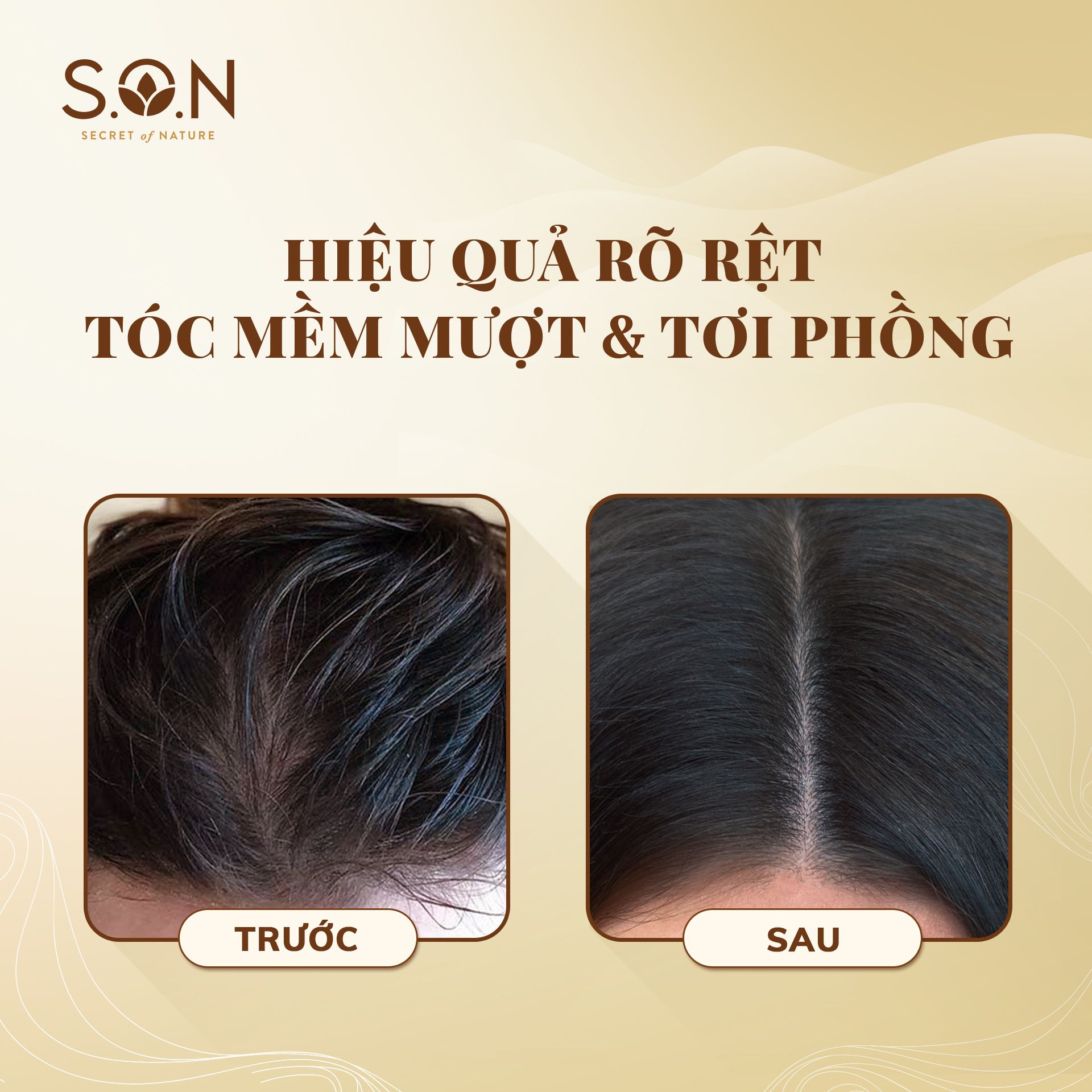  Dầu Xả S.O.N Ngải Cứu & Nha Đam 250ml/450ml 