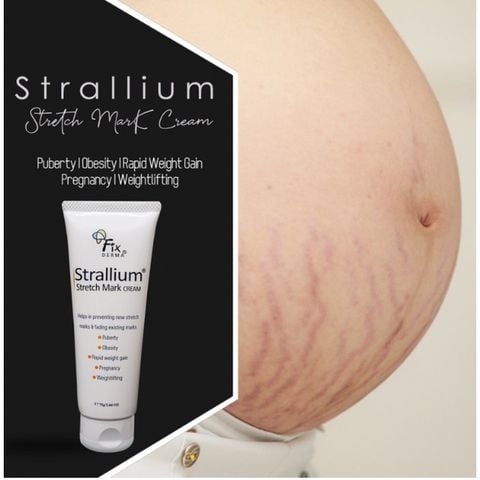 Kem mờ, ngừa rạn da Fixderma Strallium Stretch Mark Cream 75g