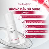  Toner Tạo Bọt Đậu Tương Núi Làm Sạch Sâu, Cân Bằng Độ Ẩm & Trắng Da, Giảm Viêm 100ml 
