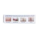 Hiruscar Silicone Pro - Trị sẹo do tai nạn, phẫu thuật, bỏng hoặc mụn (Tuýp 10g)