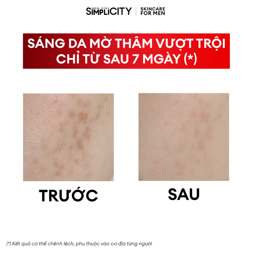  Combo làm sạch và sáng da mờ thâm tinh gọ Brightening Duo 