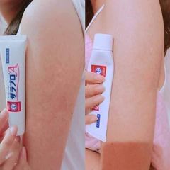 Kem trị viêm nang lông Zaraporo
