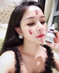 Serum  RED PELL TINGLE