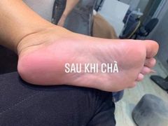 Chà gót chân P02 VACOSI