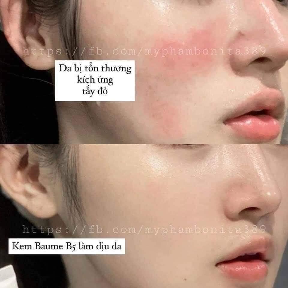 Kem dưỡng ẩm phục hồi da B5 Laroche Posay