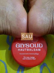 DƯỠNG DA TOÀN THÂN, TRỊ NỨT GÓT CHÂN   GLYSOLID  ĐỨC