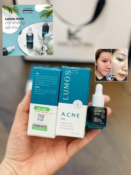 Trị mụn LUMOS