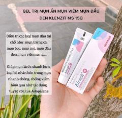 Trị mụn Klenzit MS