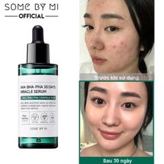 Serum SOME BY MI