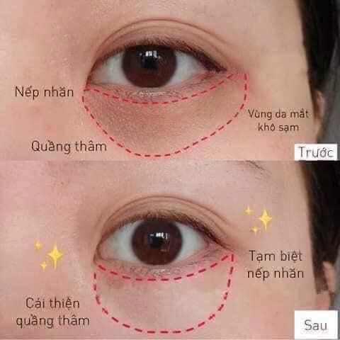 Mặt nạ mắt JM