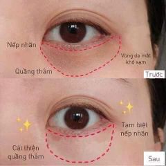 Mặt nạ mắt JM