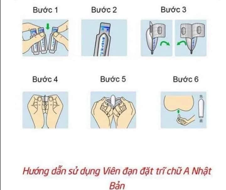 Viên đặt trĩ nội chữ A Nhật