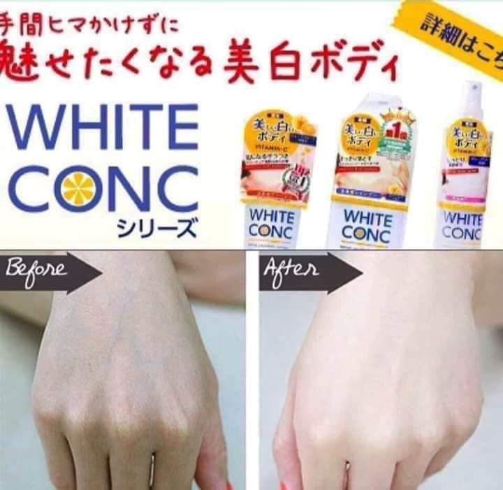 Sữa tắm trắng da WHITE CONC