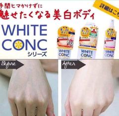 Sữa tắm trắng da WHITE CONC